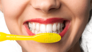 teeth whitening maintenance