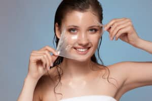 chemical peel procedure